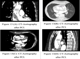 Clinical Images and Case Reports Journal (CICRJ)